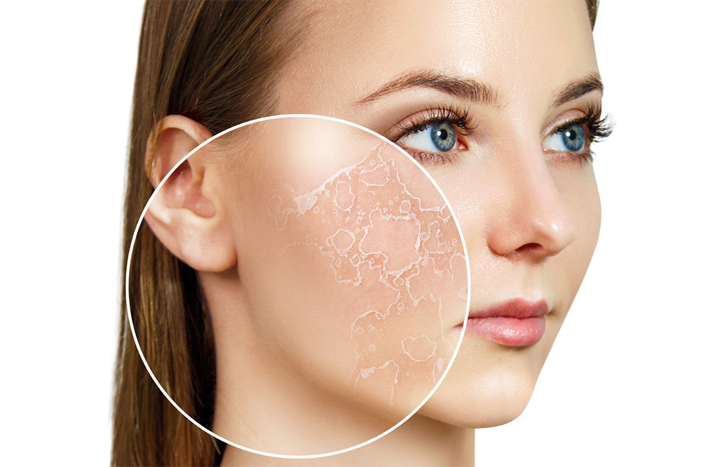 THE DIFFERENCE BETWEEN DRY SKIN AND DEHYDRATED SKIN EXPLAINED.