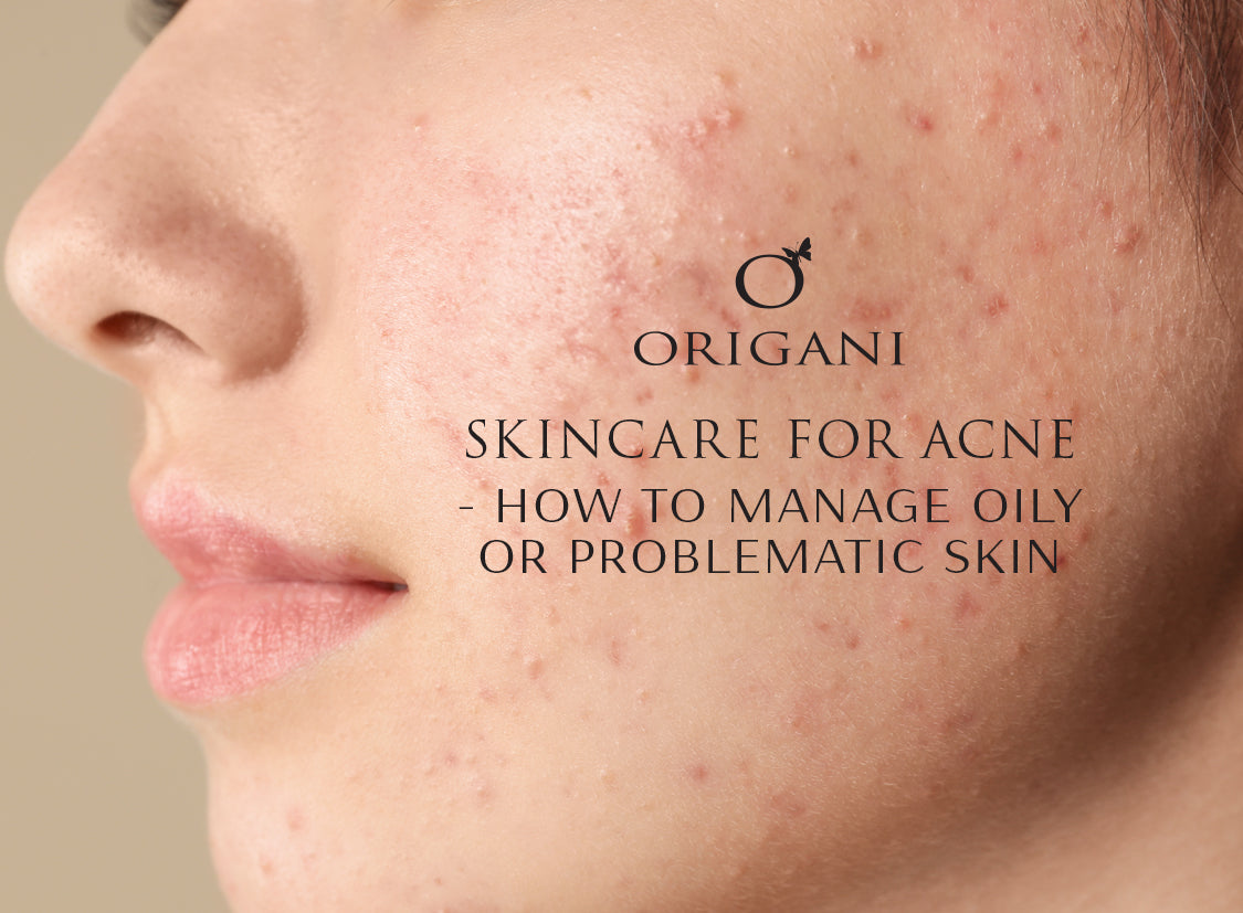 How To Cleanse Oily Skin