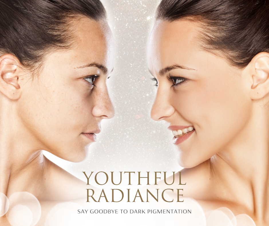 Say Goodbye to Dark Pigmentation 